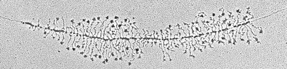 fuzzy image of an active gene chromatin spreading