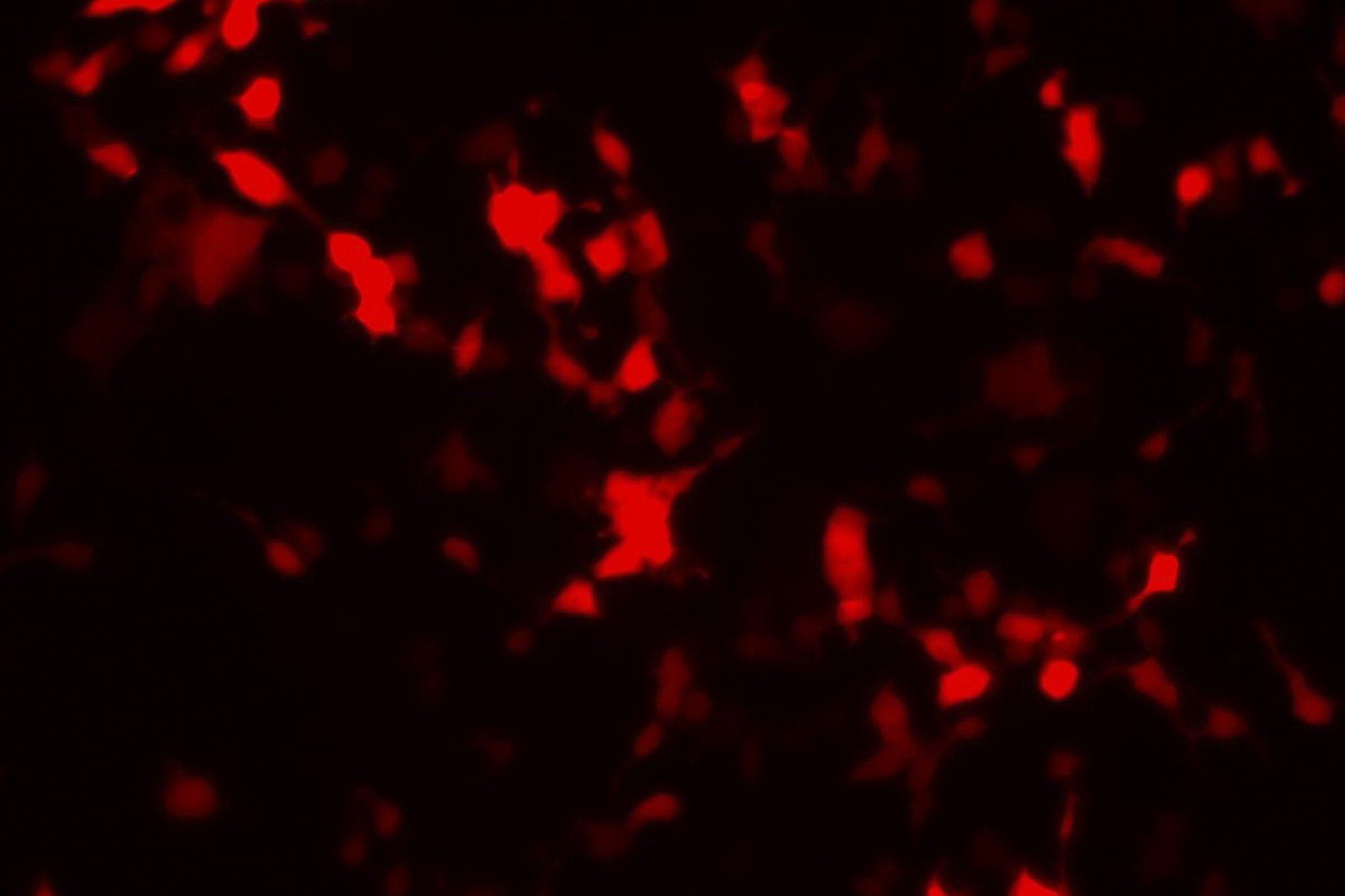 green biosensor cells that are red.  Look like speckles of red on a black background