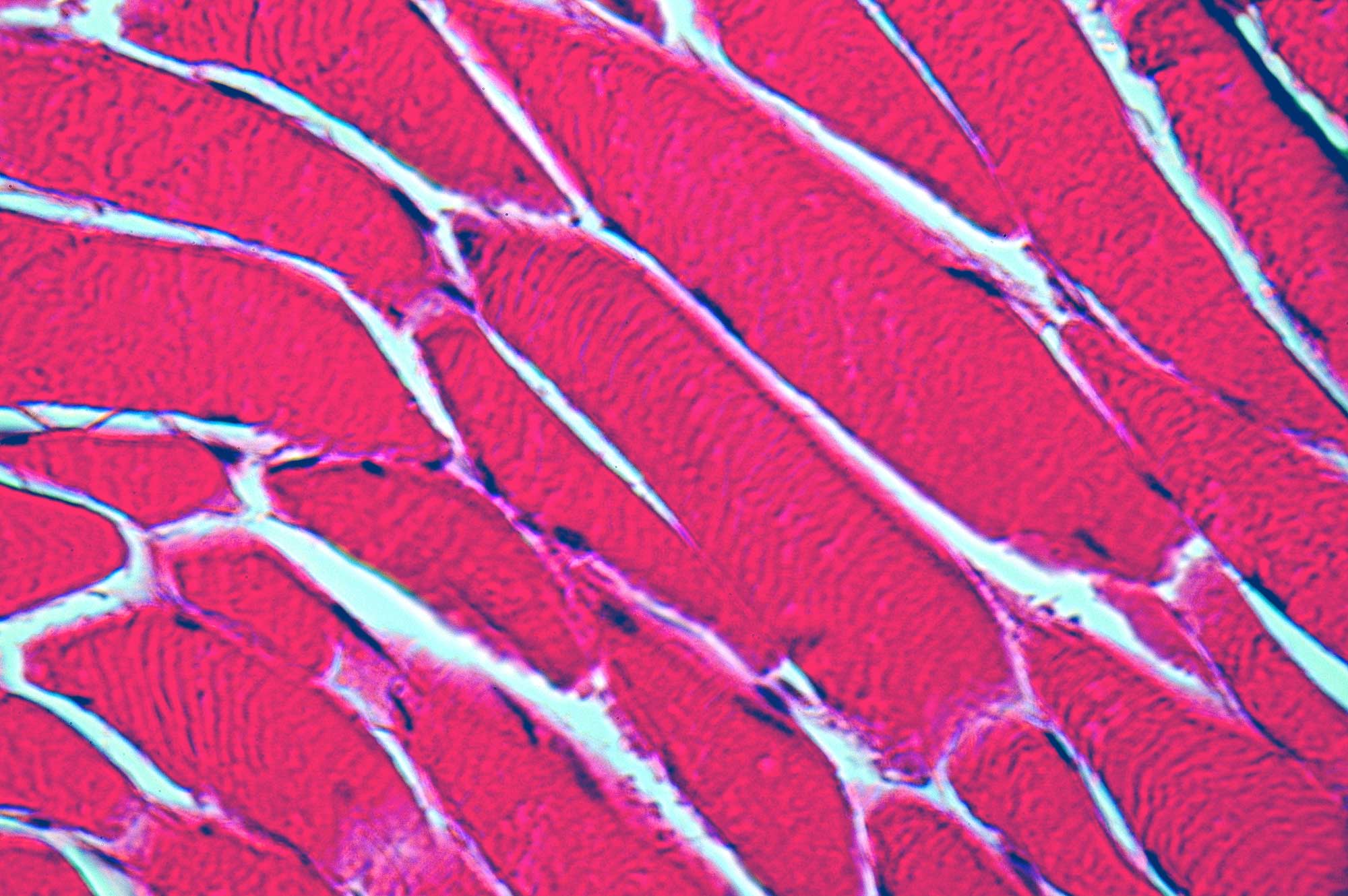 Illustration of muscle tissue