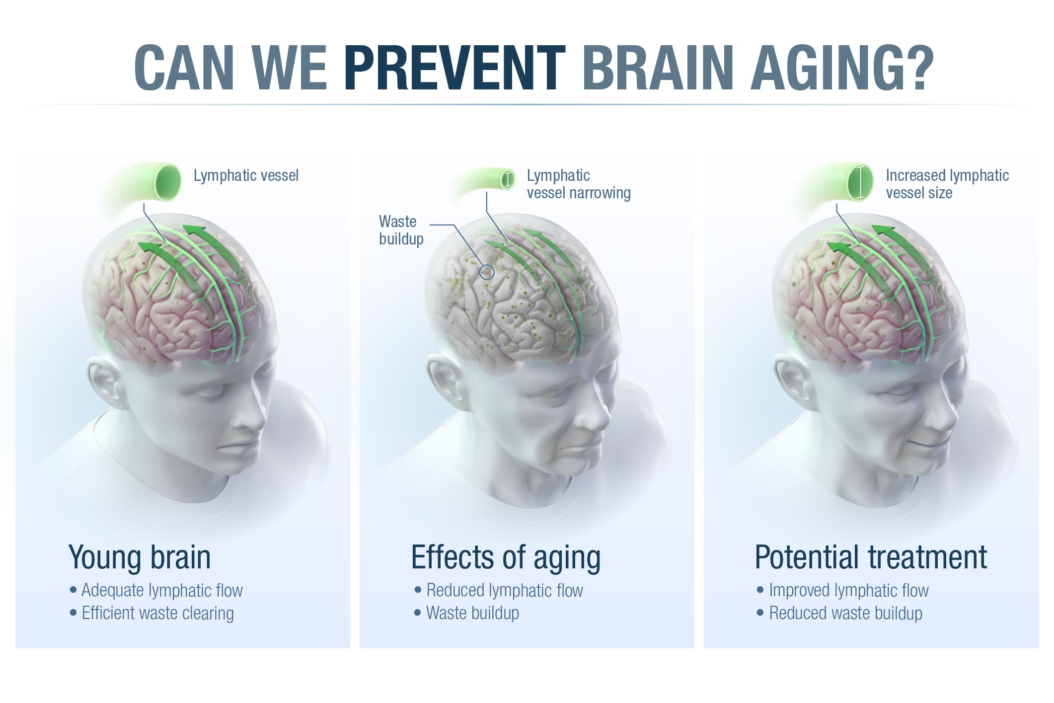 illustration of a head withe face again.  Top text reads: Can we prevent brain aging? Left image: Young brain adequate lymphatic flow efficient waste clearing Middle Image: Effects of aging reduced lymphatic flow waste buildup Right Image: potential treatment improved lymphatic flow reduced waste buildup
