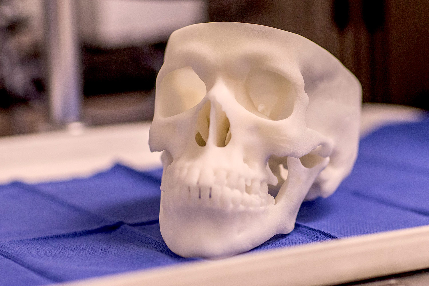 Patient CT or MRI scans are converted to 3-D printable files to create the 3-D printed skull models.