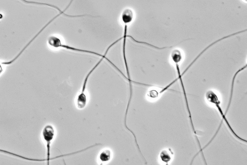 Human sperm viewed by phase contrast microscopy.