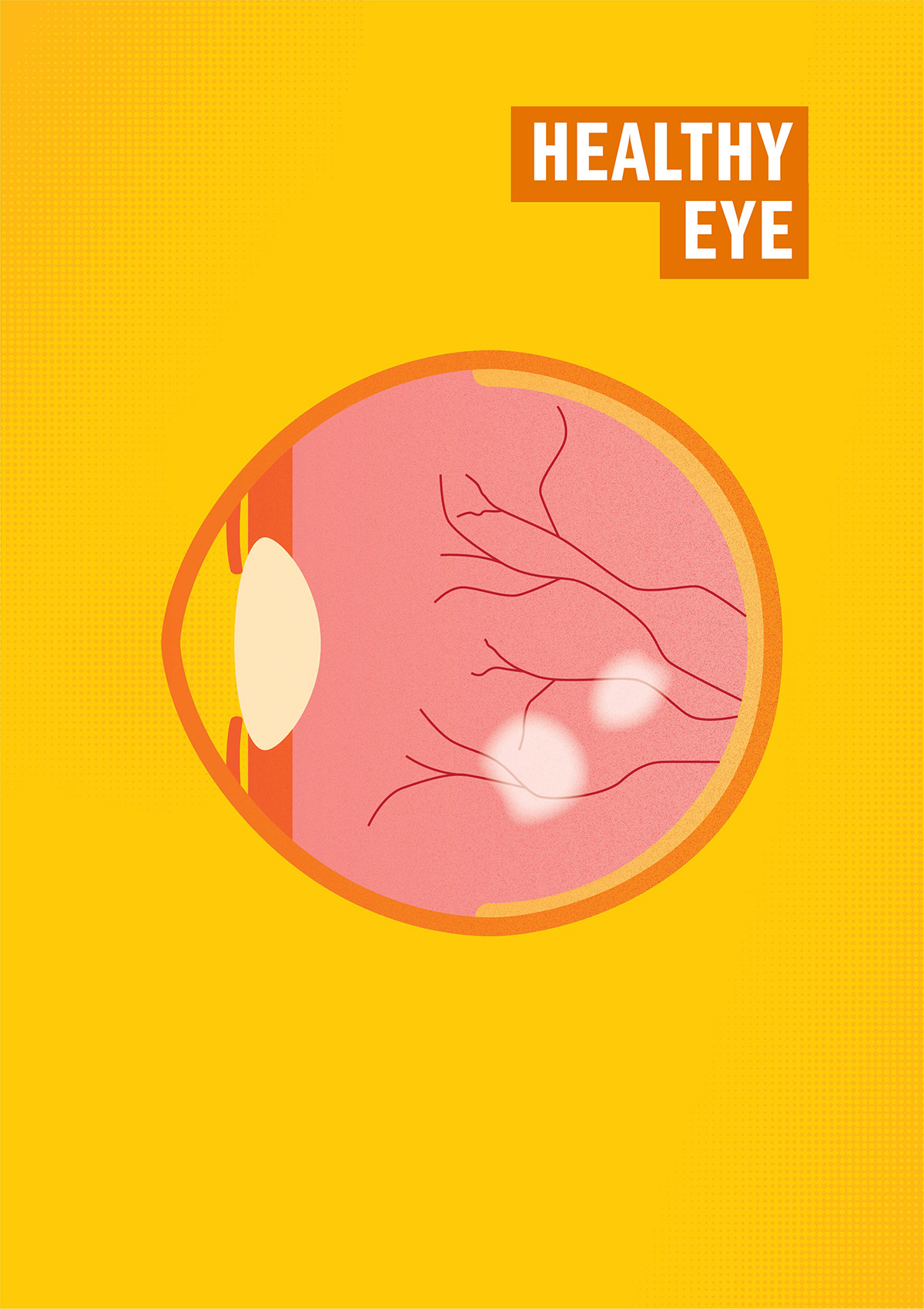 Healthy Eye