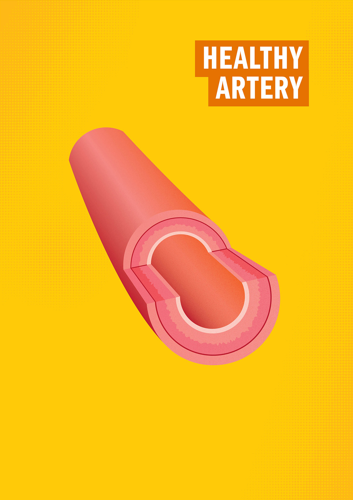 Healthy Artery