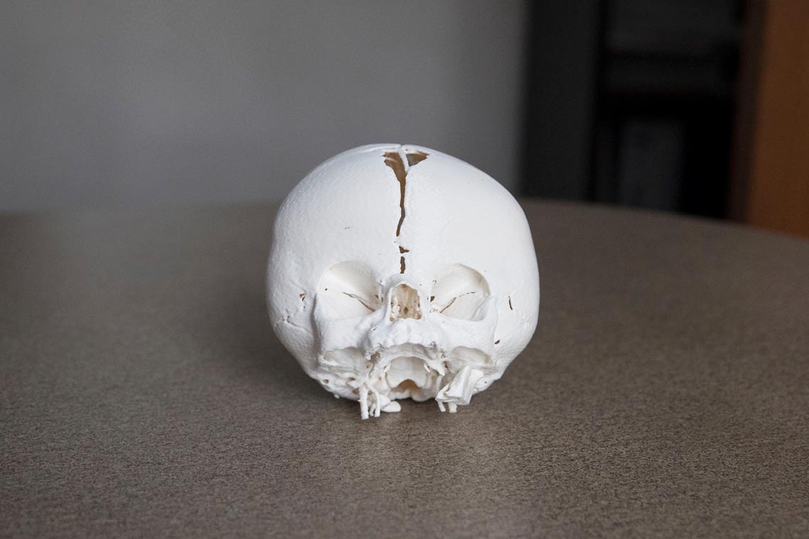 Round skull with a hole in the top