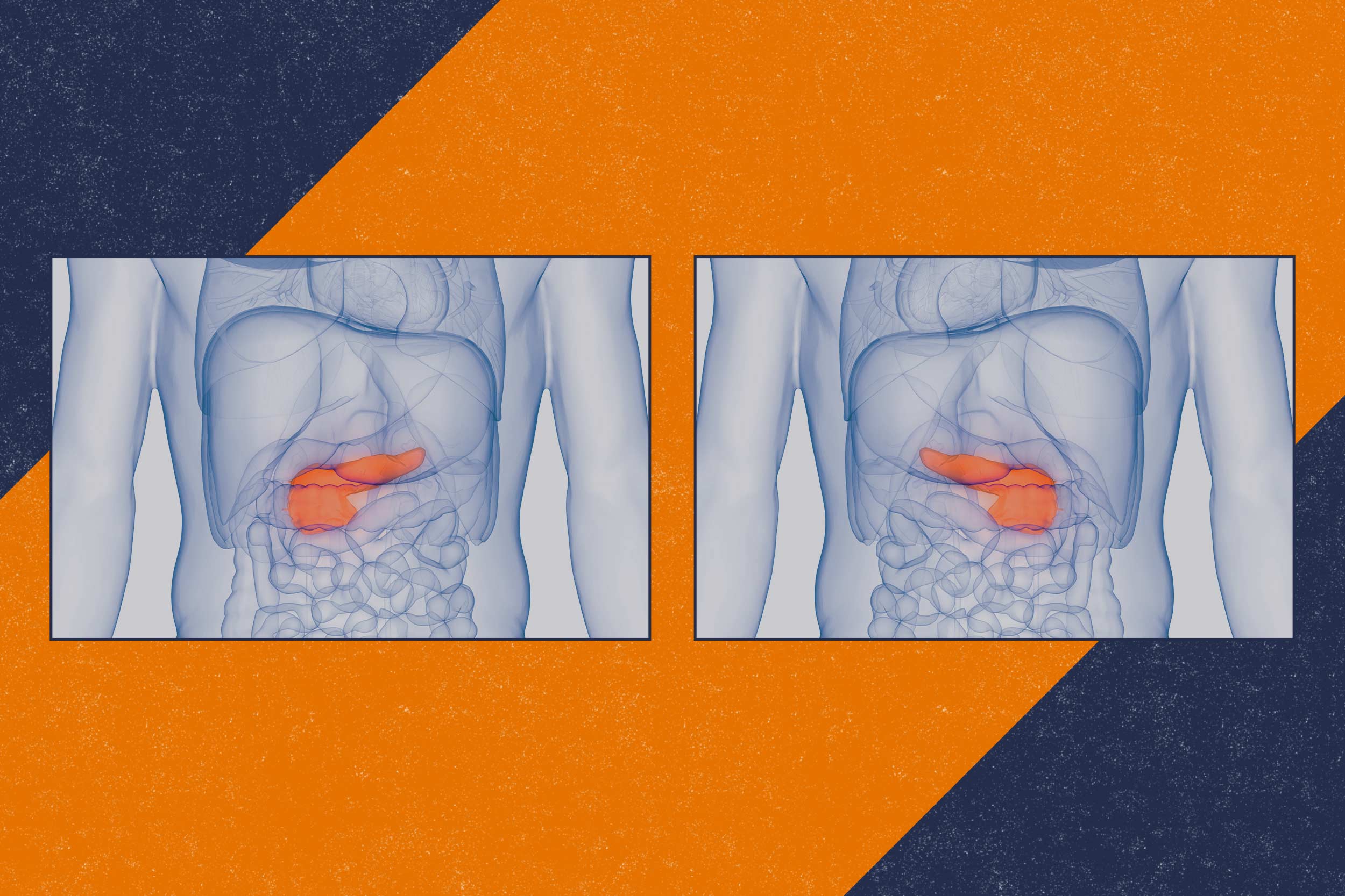 illustration of two human body diagrams showing the pancreas