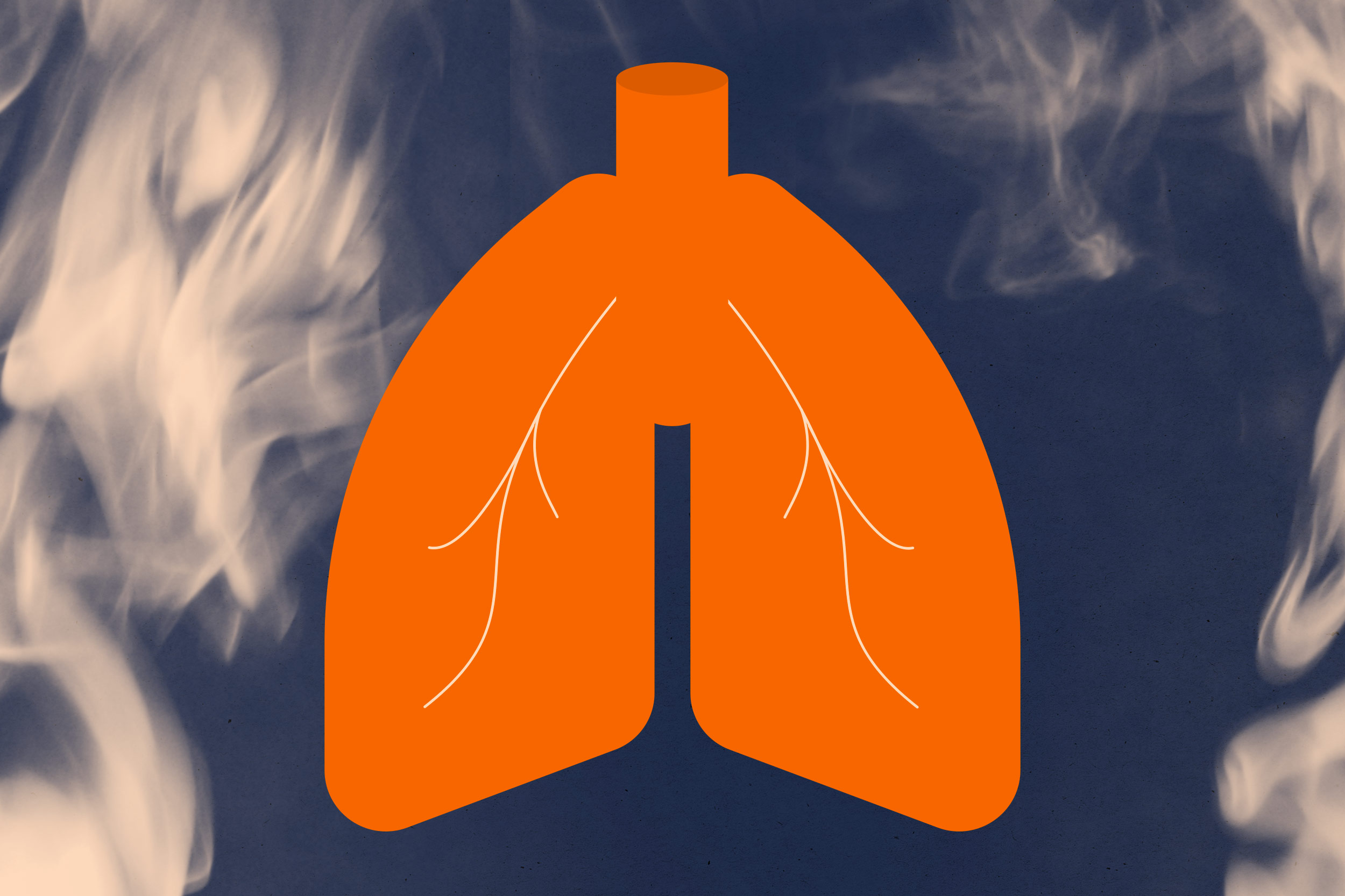 Portrait illustration of a lung with dark smoke in the background.