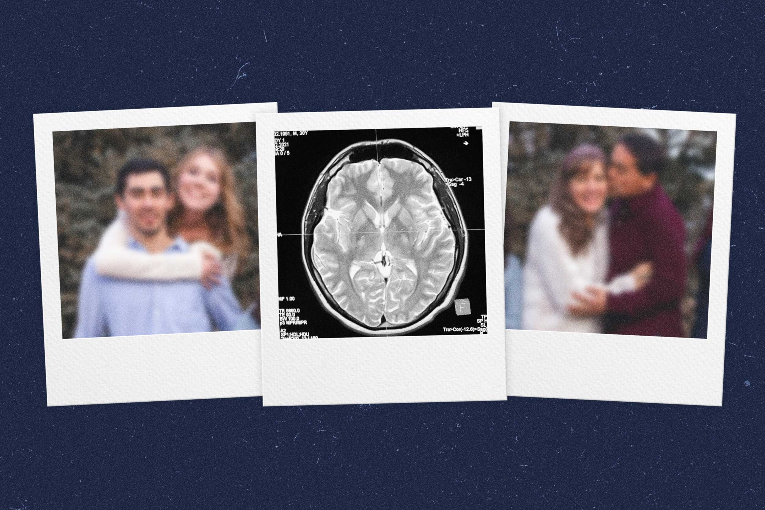 illustration of 3 instant camera photographs depicting an MRI scan of a brain flanked by two blurry photos of couples