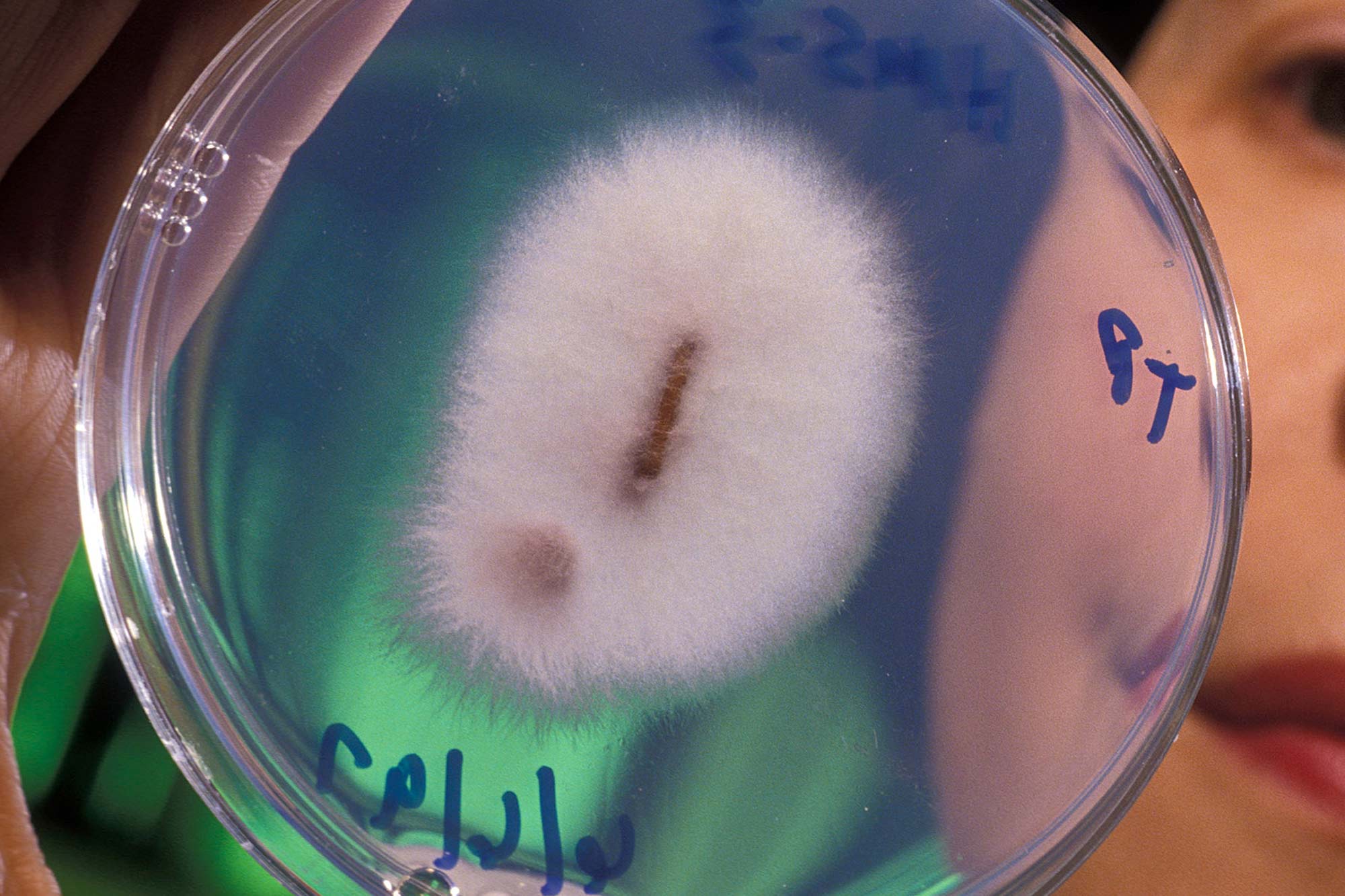 A view of a parasite in a petri dish 