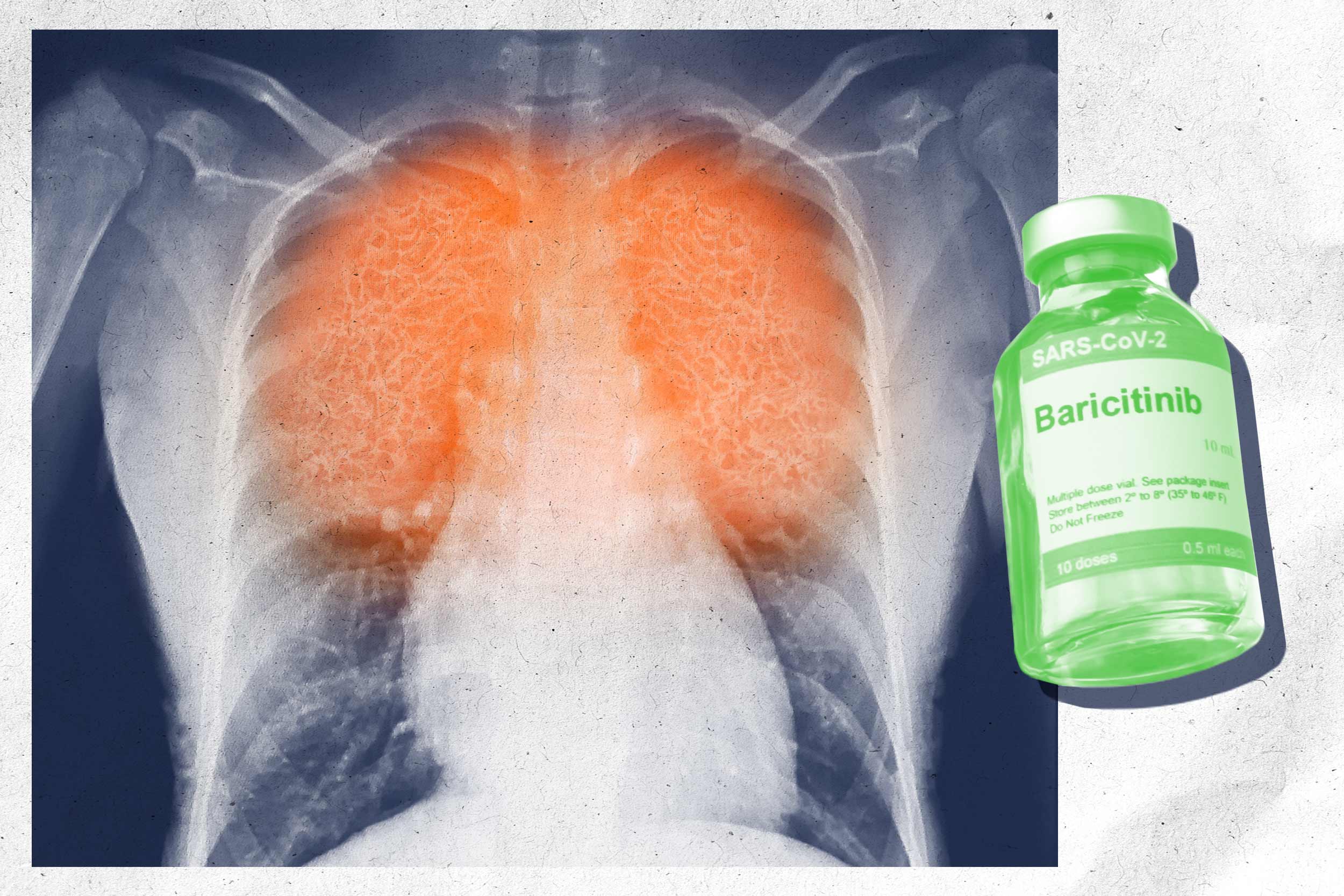 Illustration of a human chest X-ray with a focus on the internal organs and small medicine bottle..