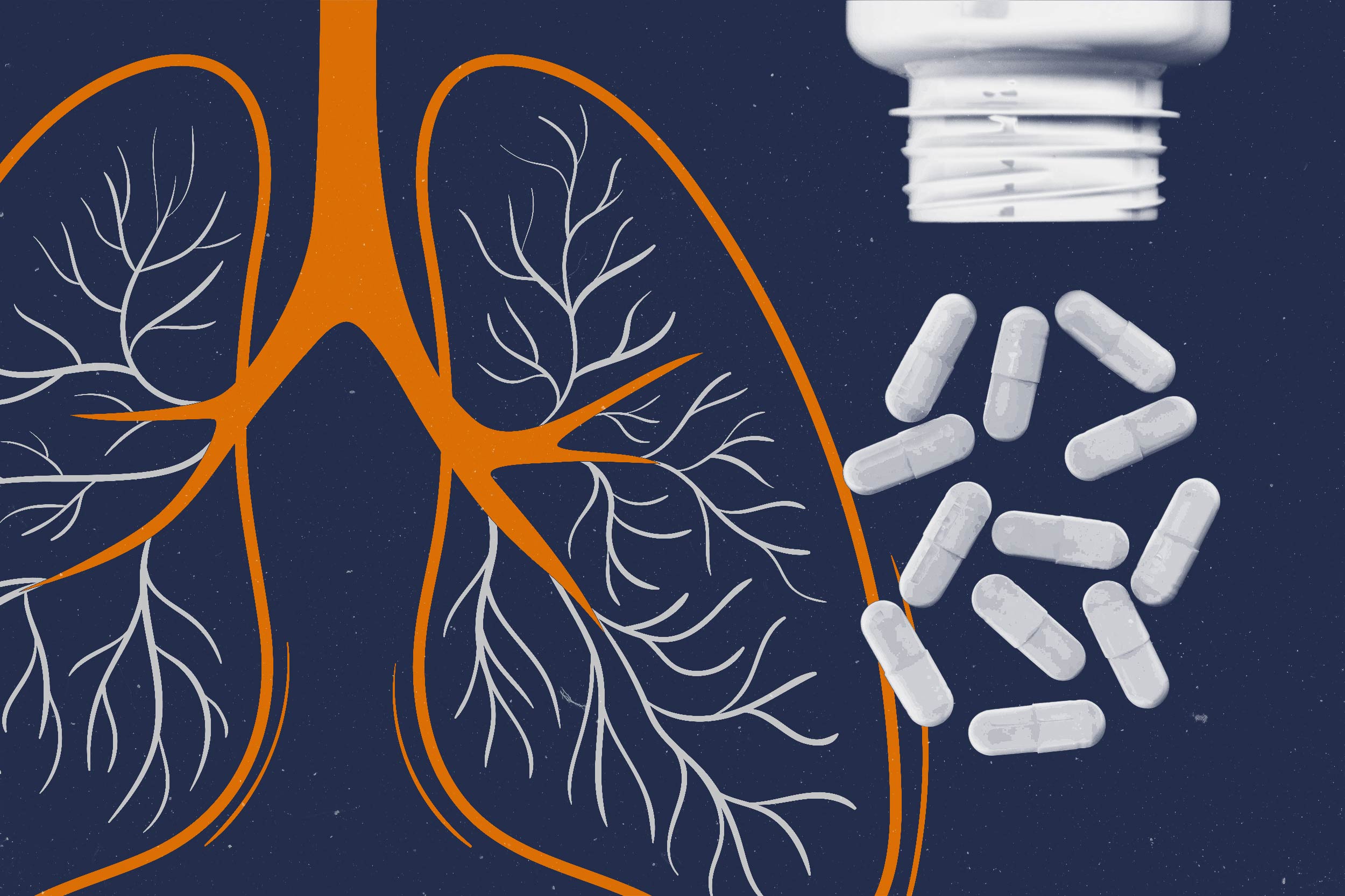The Road to $532 Million: Can a Supplement Save Patients From Deadly Lung Scarring?