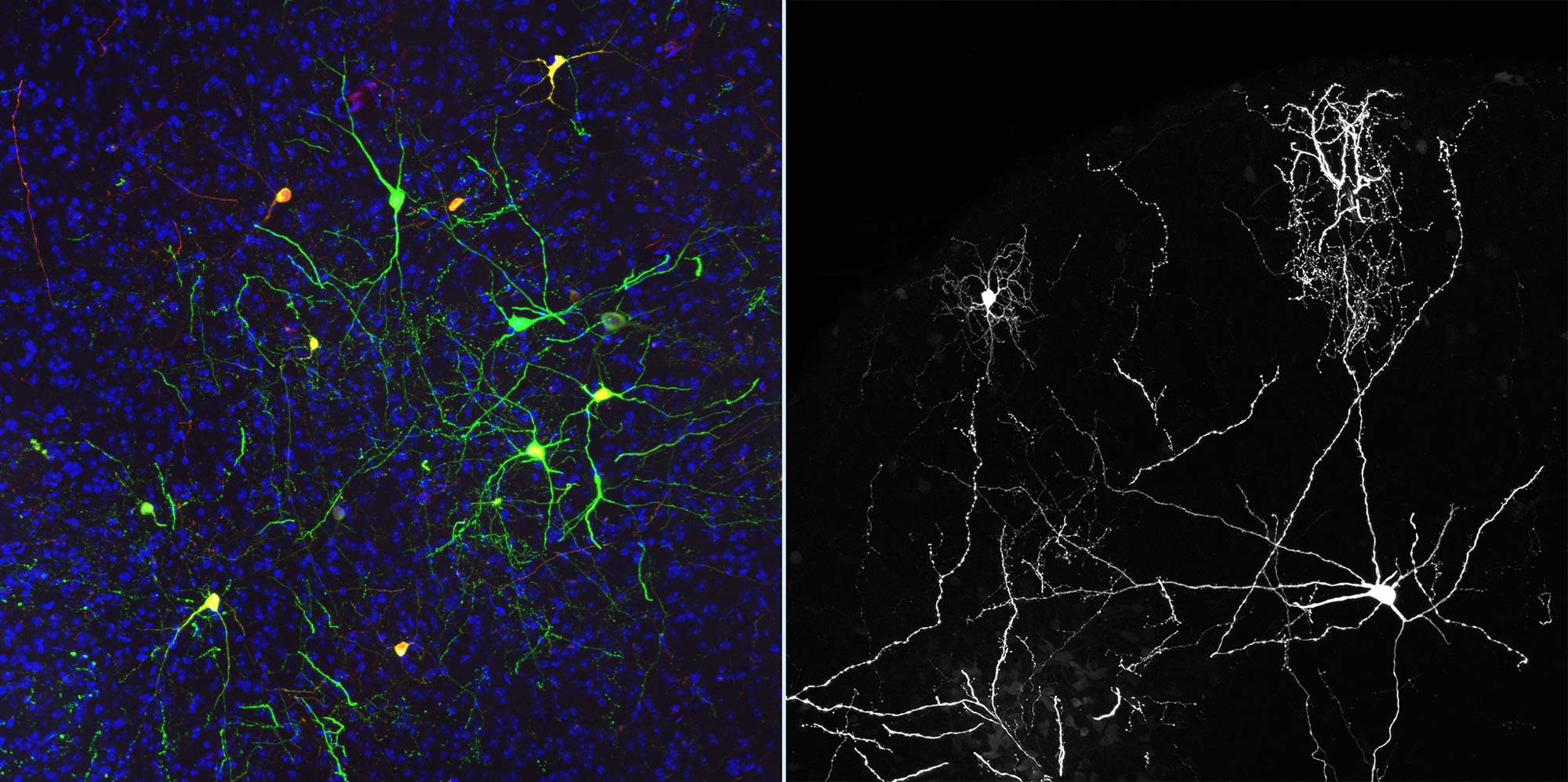 Microscope images demonstrate neuronal change.