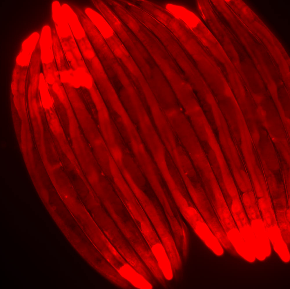 Microscope image of roundworms