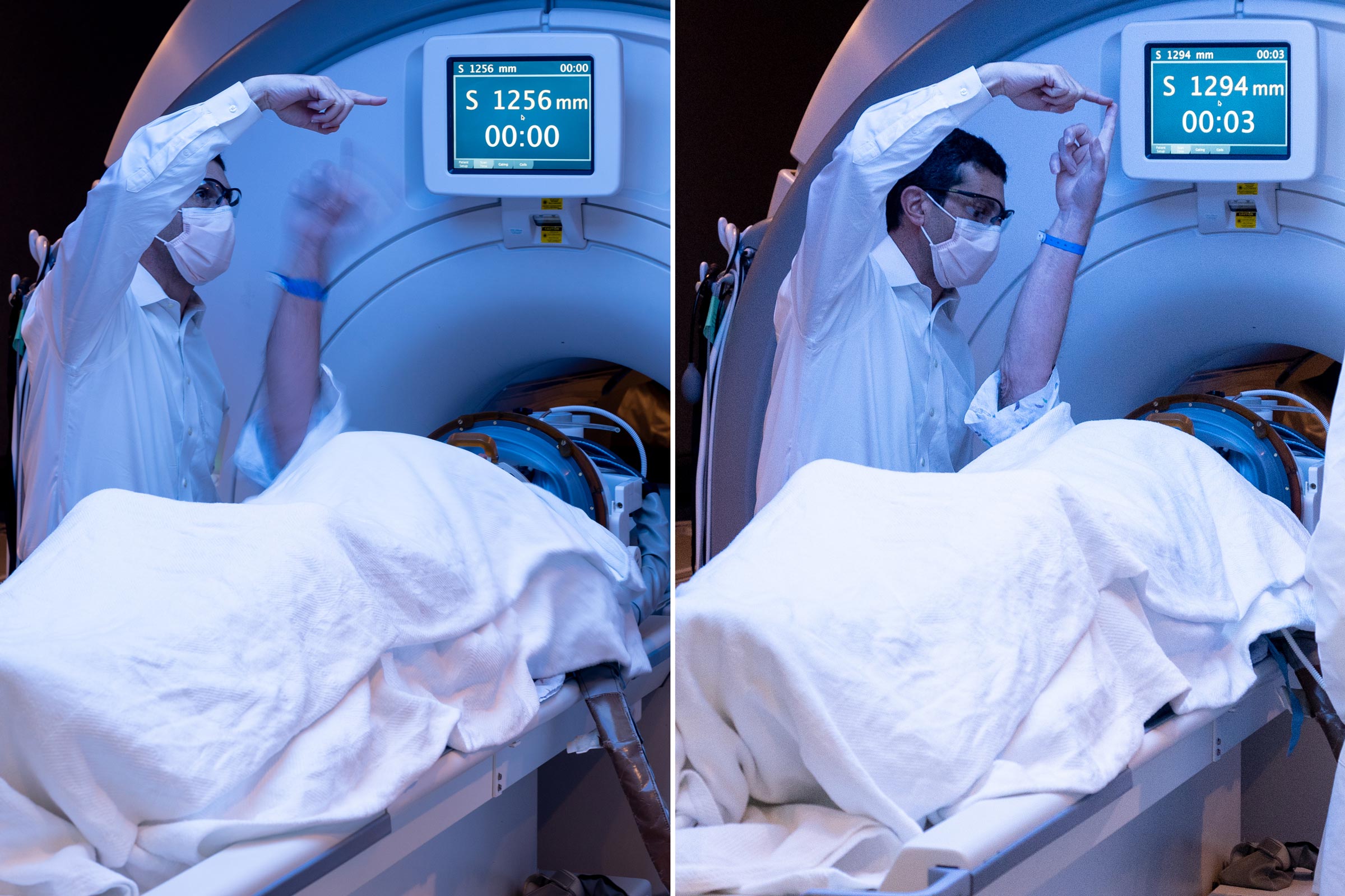 Side by side pictures of a patient suffering from essential tremor before and after a focused ultrasound session.