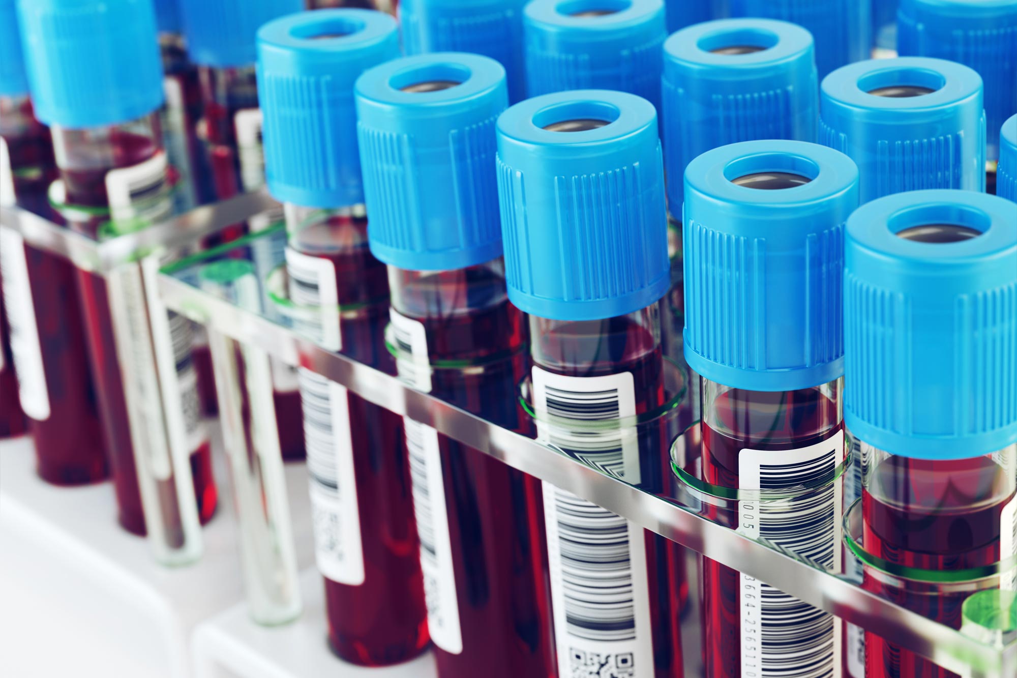 close up of test tubes with blood in them