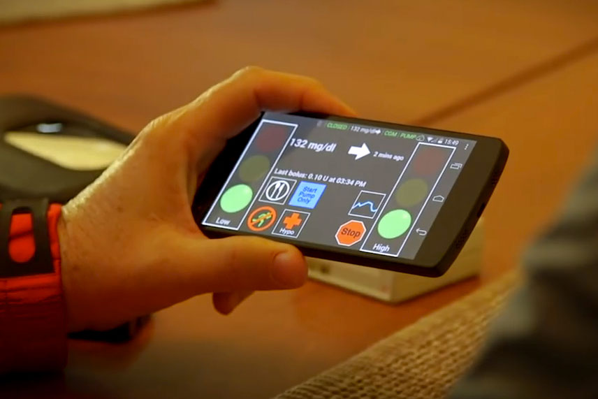 Person holding a cell phone looking at the artificial pancreas app readings