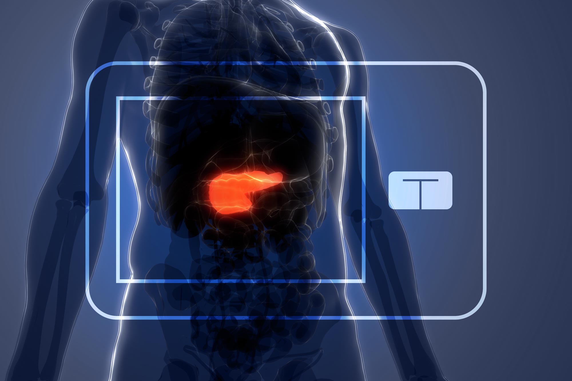 see through human body with a red pancreas on the body.  Two squares (an inner and an outer square) in the shape of the new artificial pancreas