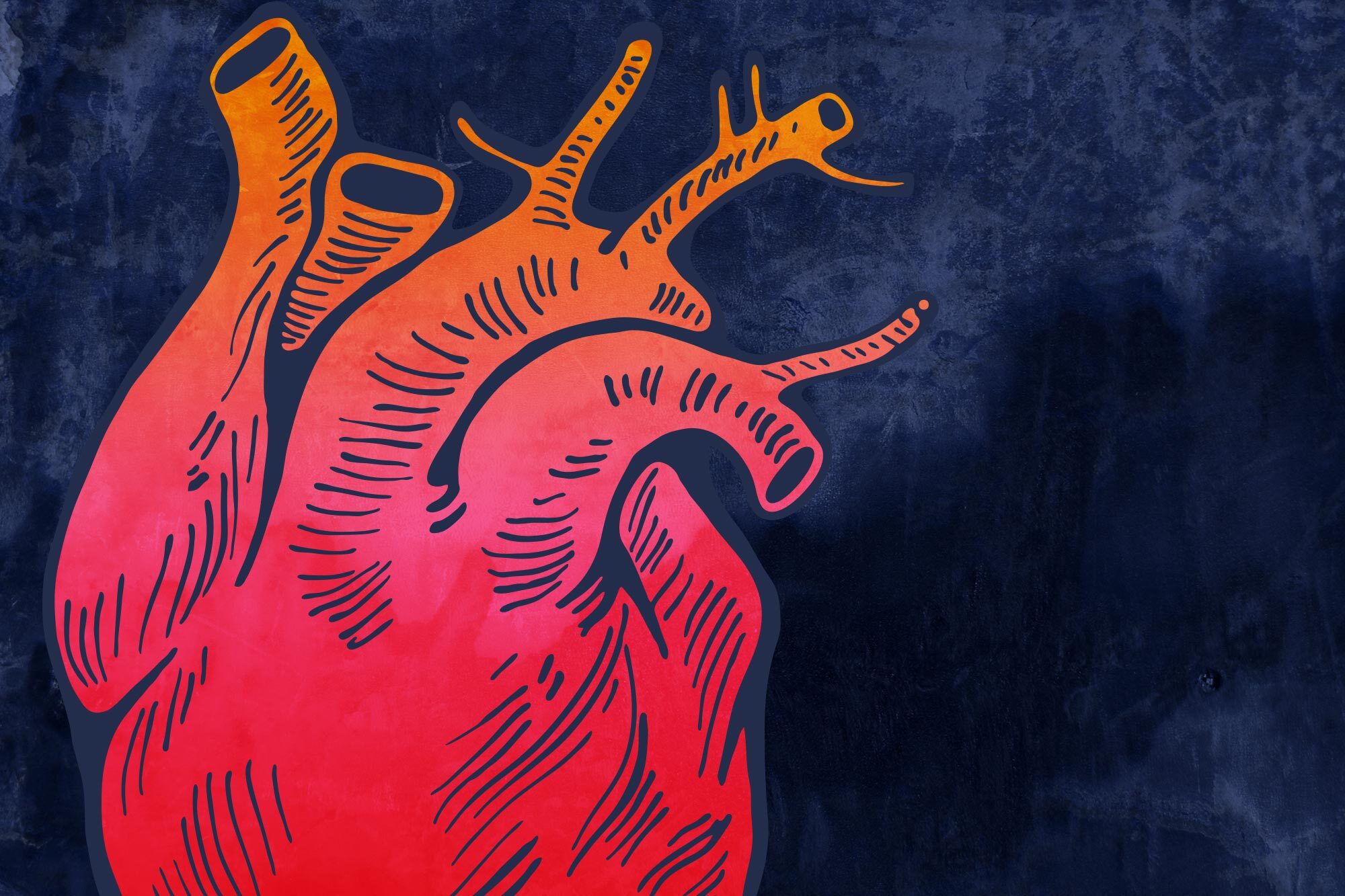 Heart Attacks, Heart Failure, Stroke: COVID-19’s Dangerous Cardio Complications