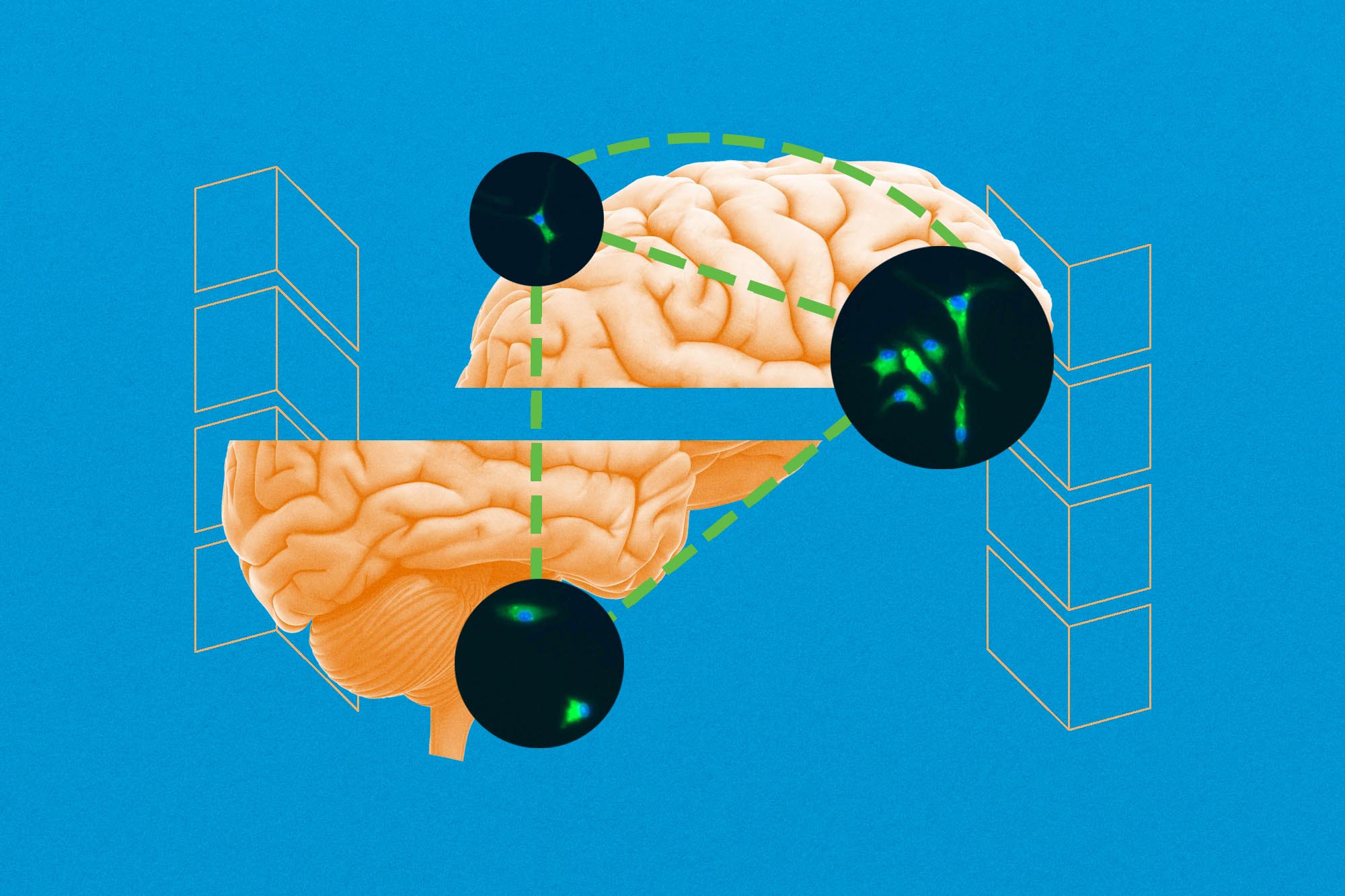 Illustration of a brain split with green lines showing electrical magnetic current in brain