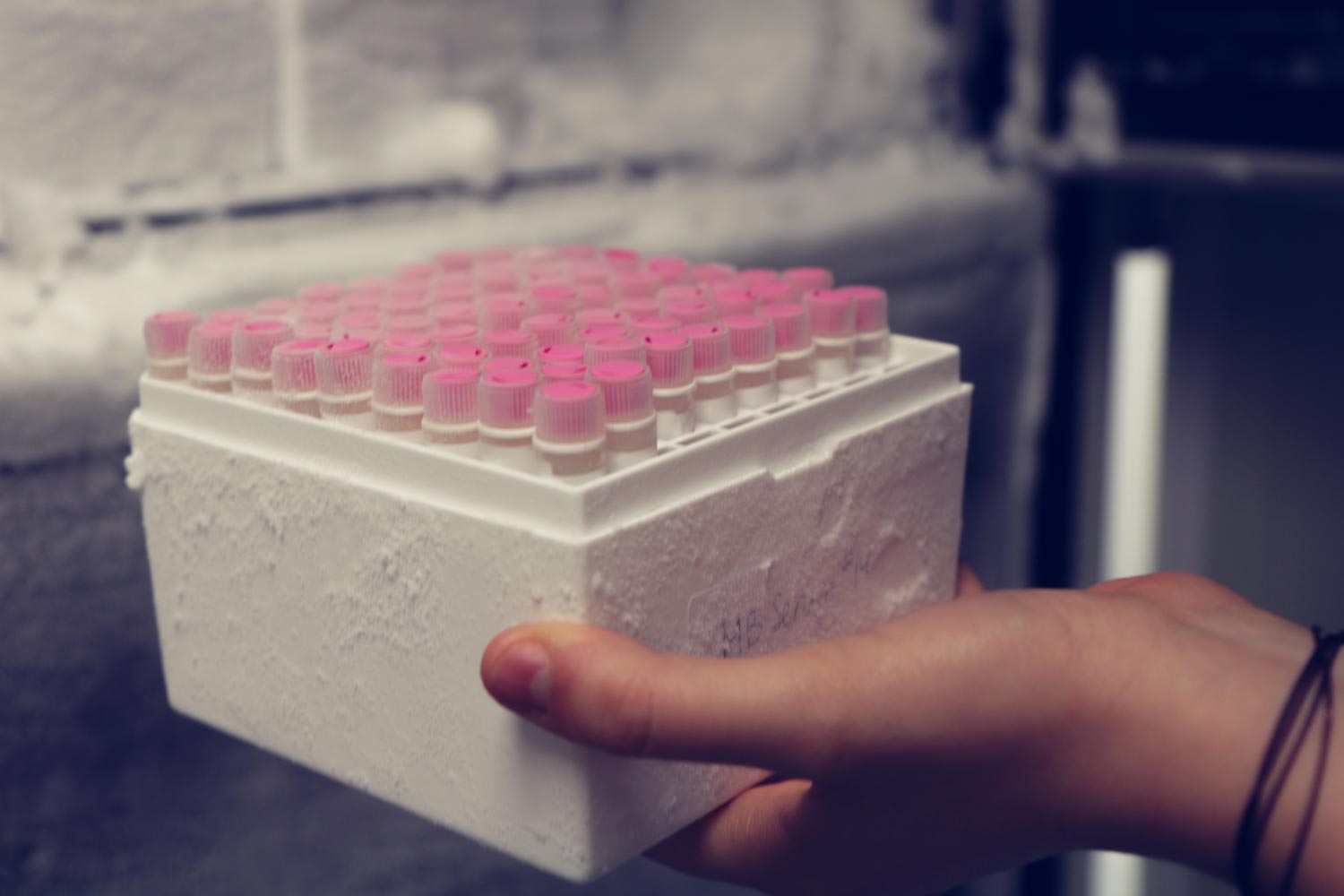 biological samples in a frozen plastic box