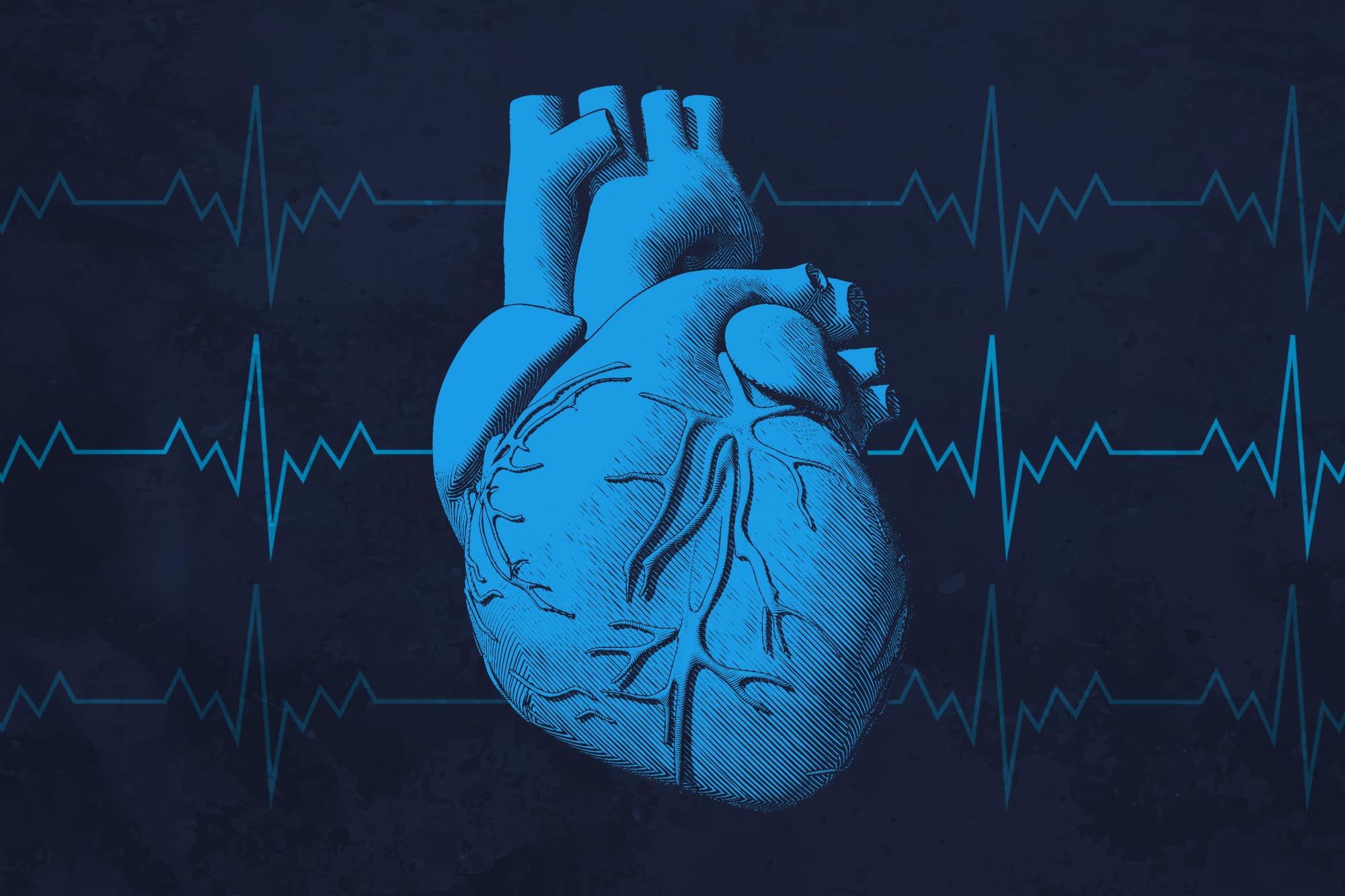 Illustration of a human heart with EKG in the background