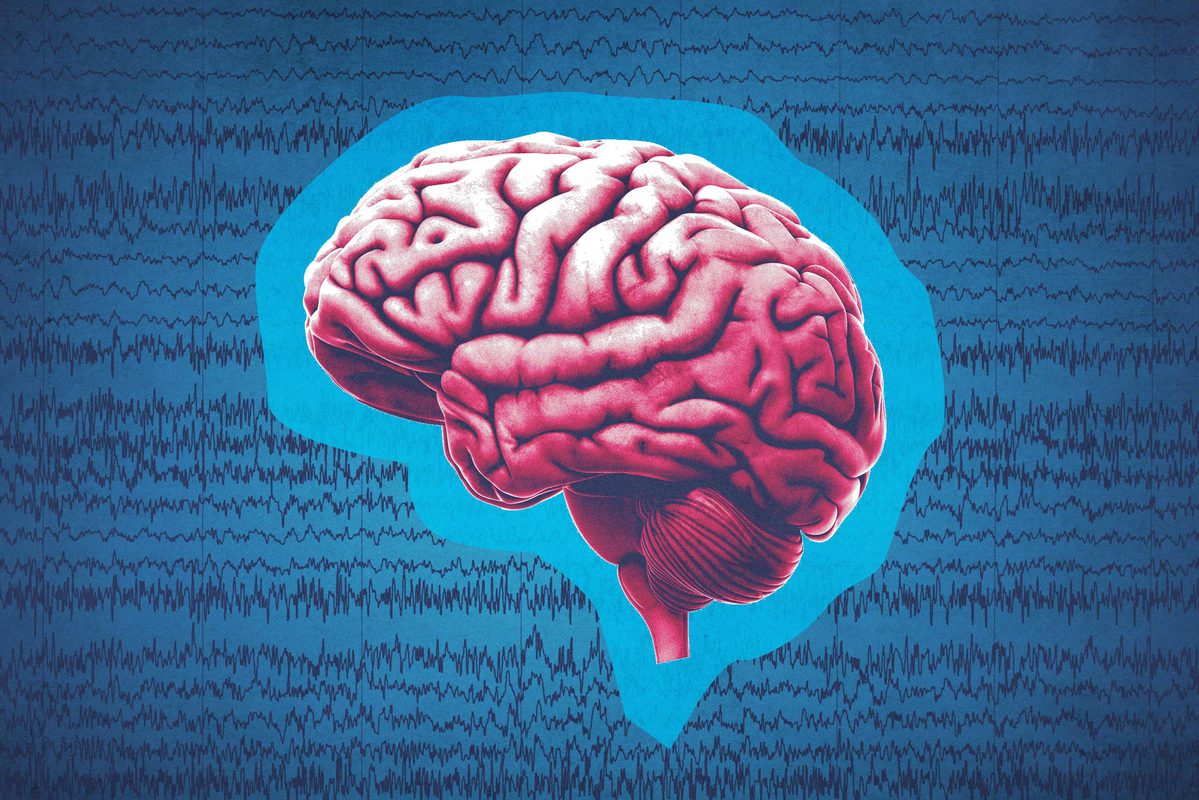 epilepsy brain diagram