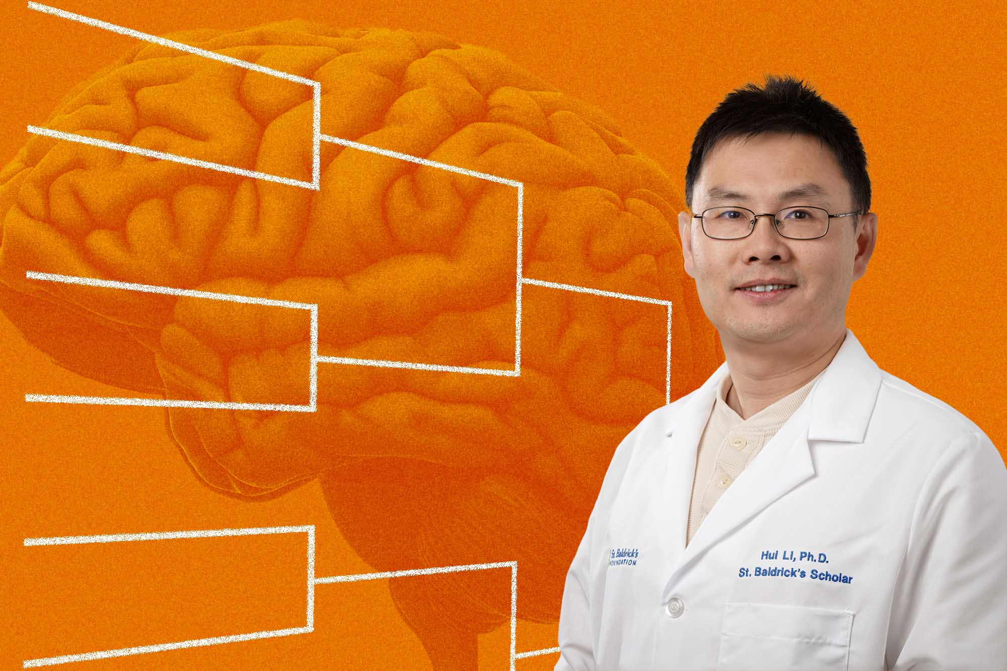 graphic of Dr. Hul Li overtop of a brain and a bracket