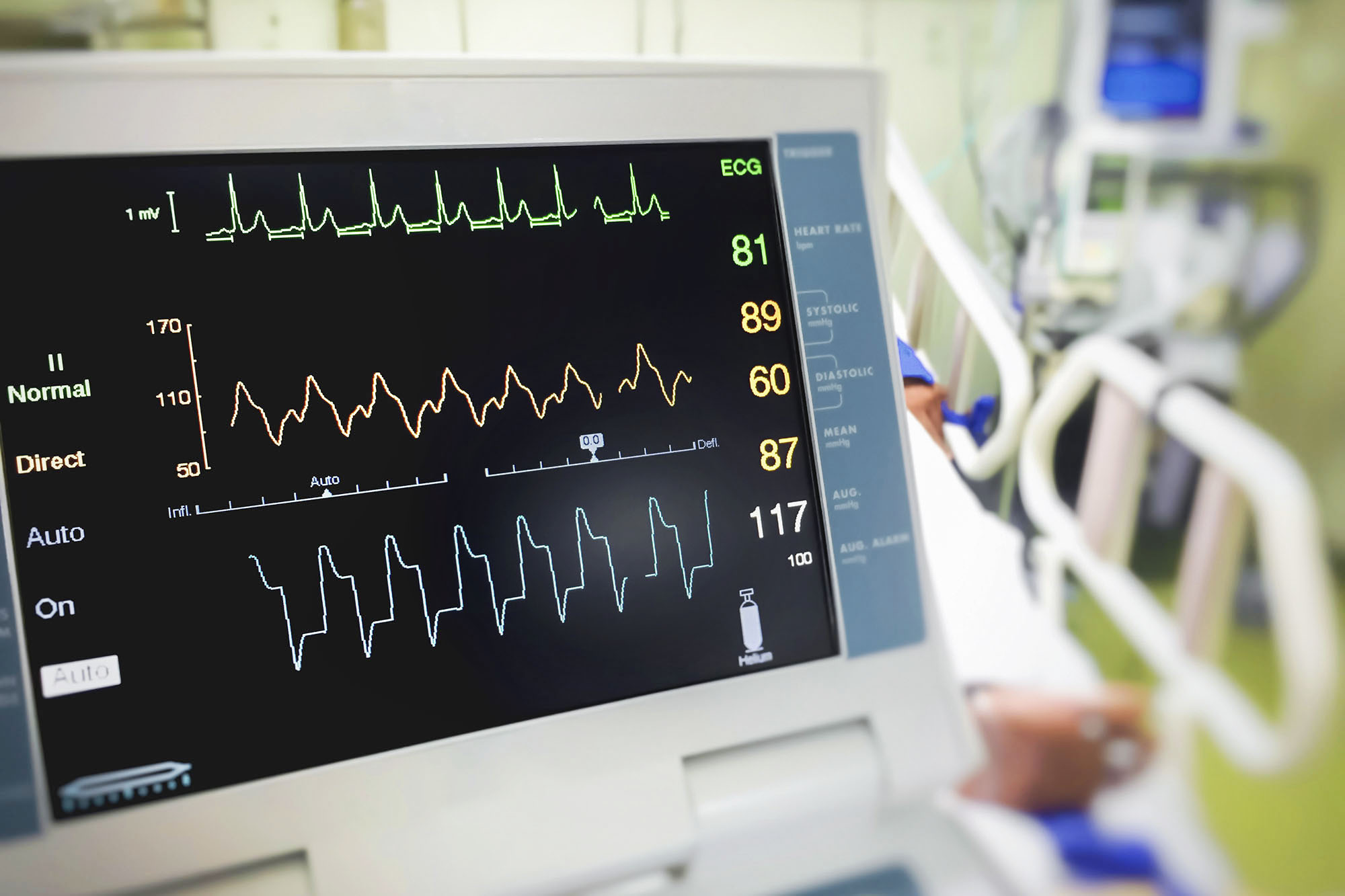 ICU ECG Monitor