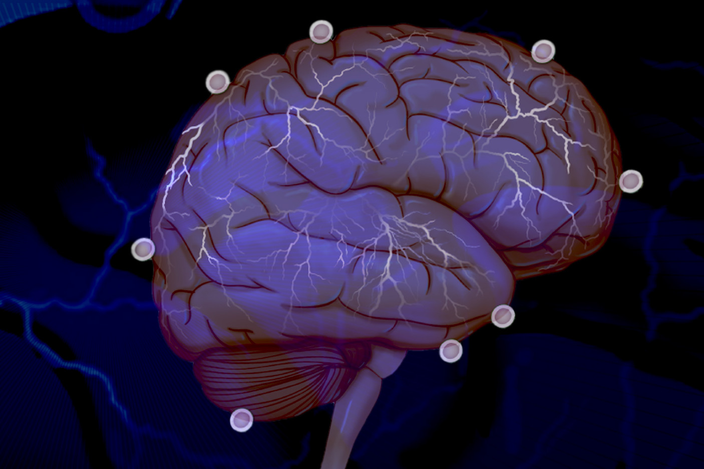 Illustration of a brain with multiple lightening bolts in it