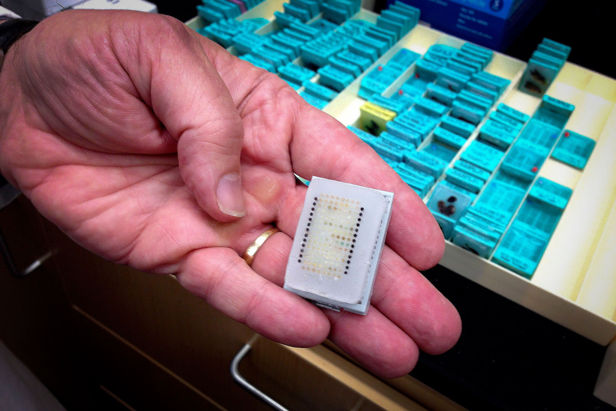 Person holding a microarray