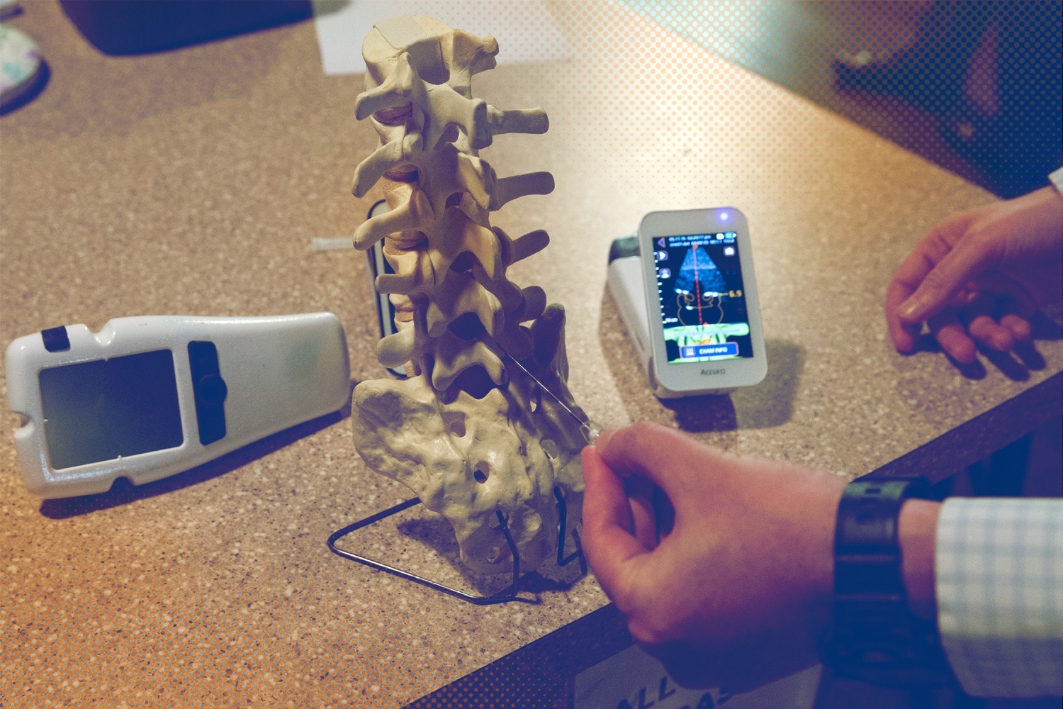 Accuro device being used on a clinical spine to show how it works