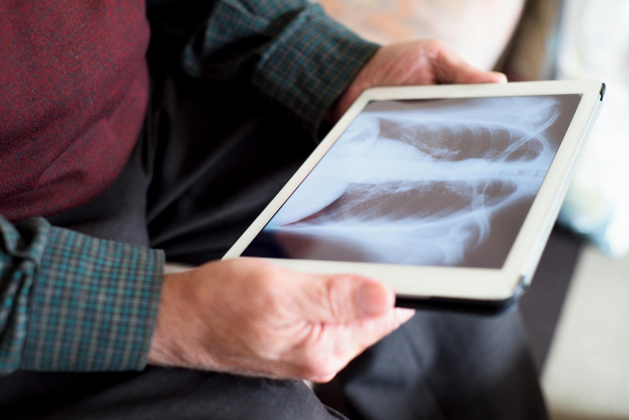 Person holding a tablet looking at a back x-ray