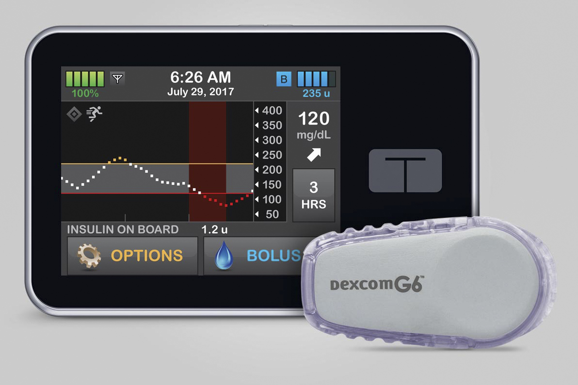 DexcomG6 device (right), and the DexcomG6 program on a device (background)