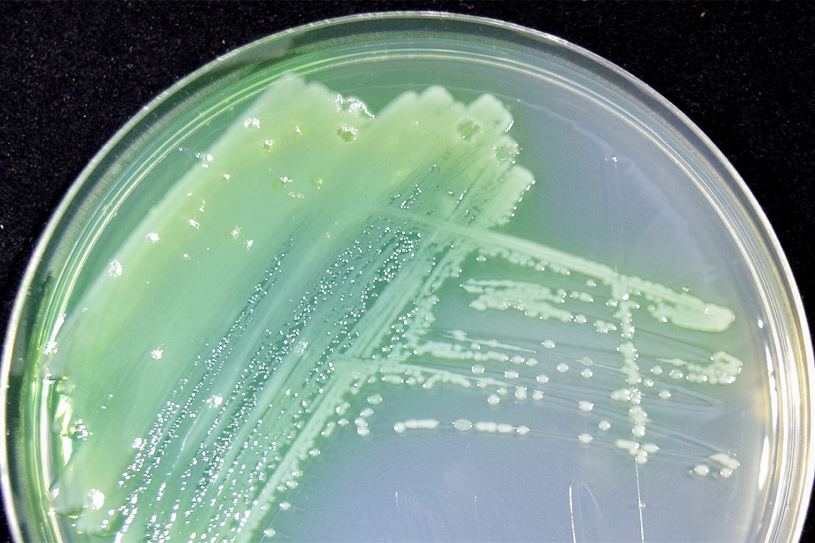 A culture of Pseudomonas aeruginosa in a petri dish