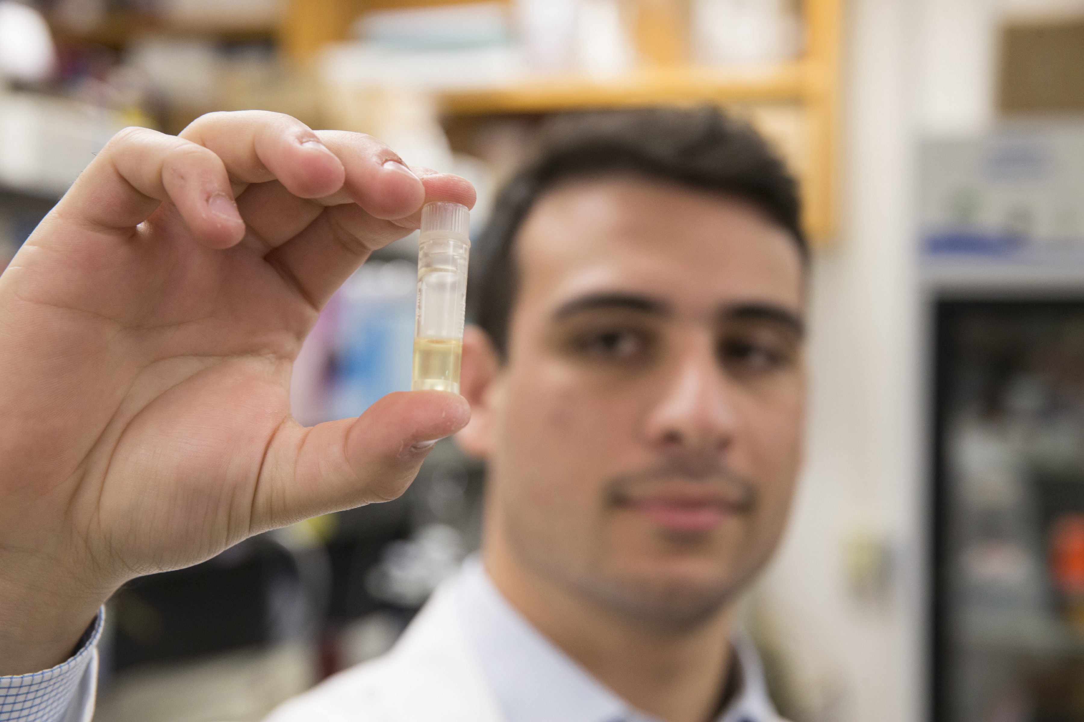 Contraline founder Kevin Eisenfrats holds a sample of the echogenic polymer gel that is basis of the non-surgical contraceptive procedure.