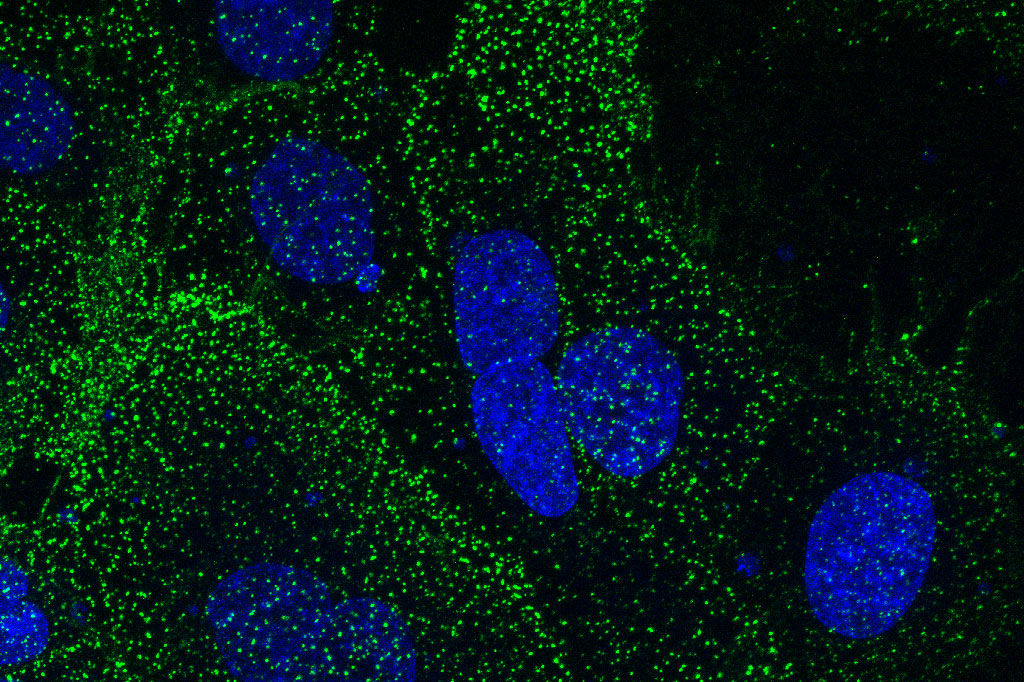 Live human uterine cancer cells, stained green where the monoclonal antibody has attached to the cell surface protein SAS1B. The blue stained structures are cell nuclei.