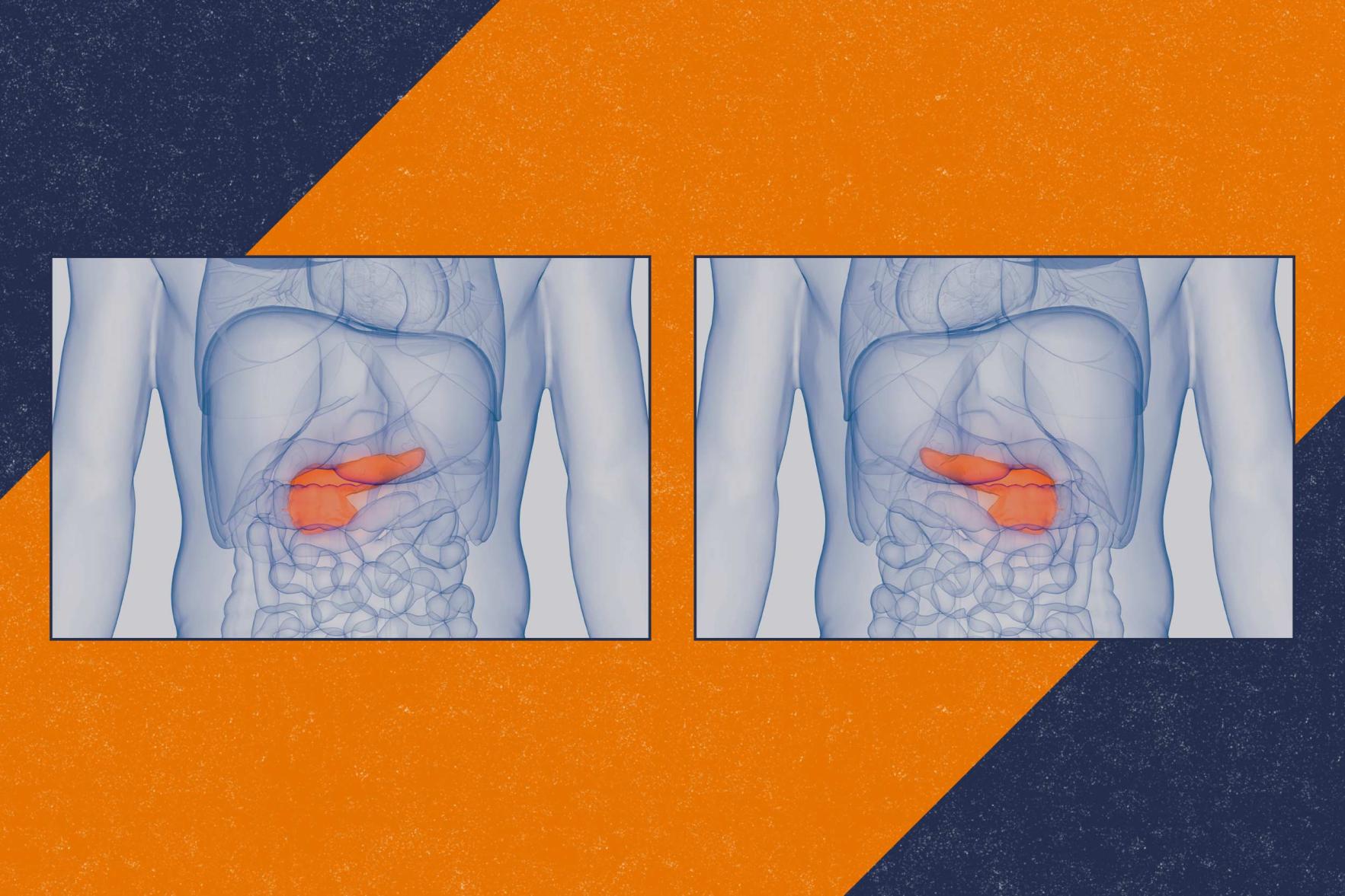 illustration of two human body diagrams showing the pancreas