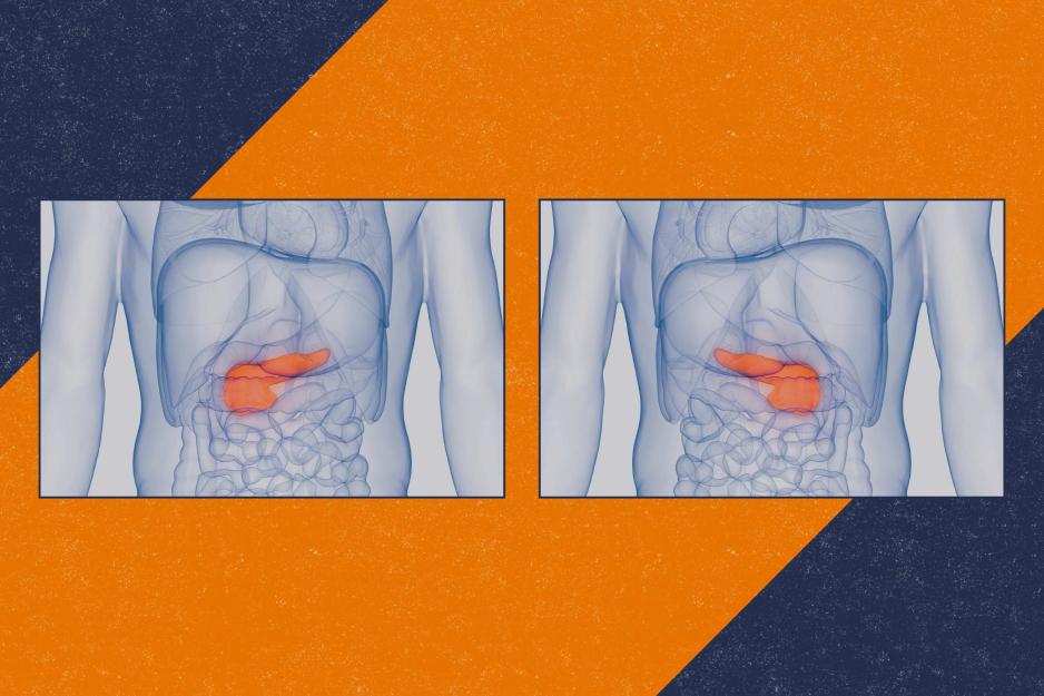 illustration of two human body diagrams showing the pancreas