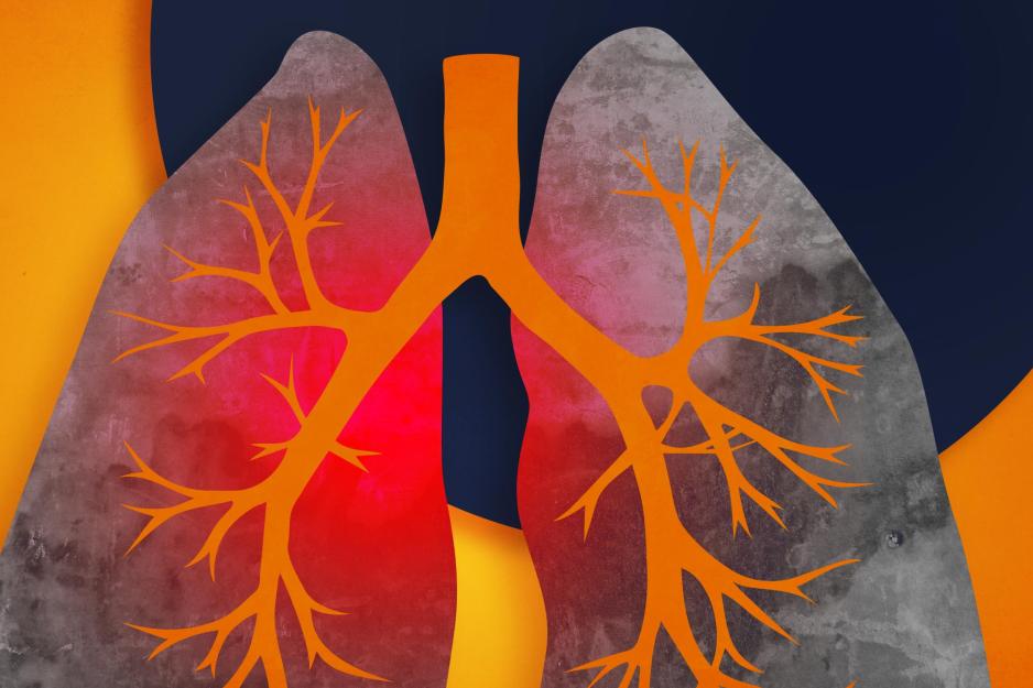 illustration of lungs with bright red on the left lung