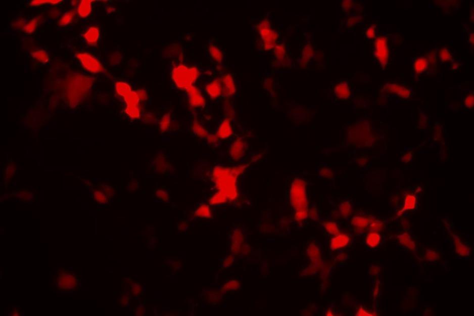green biosensor cells that are red.  Look like speckles of red on a black background
