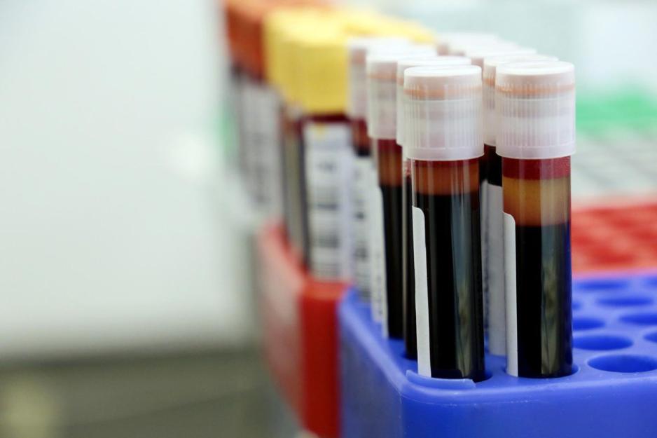 Test tubes of blood sitting in the holders waiting to be tested