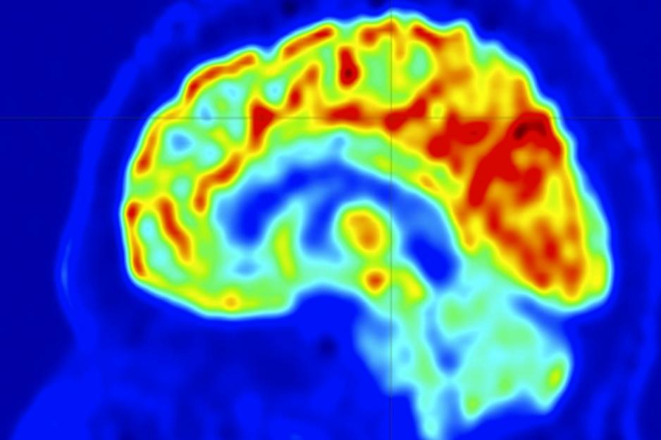 A brain map showing various colors, red, green, dark blue, and light blue