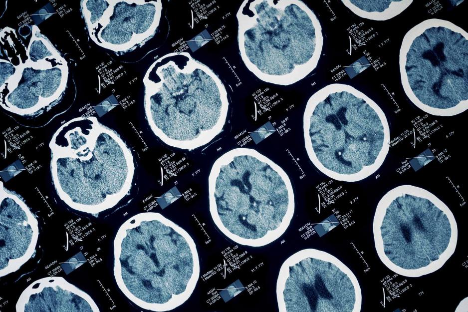 Scan of a brain