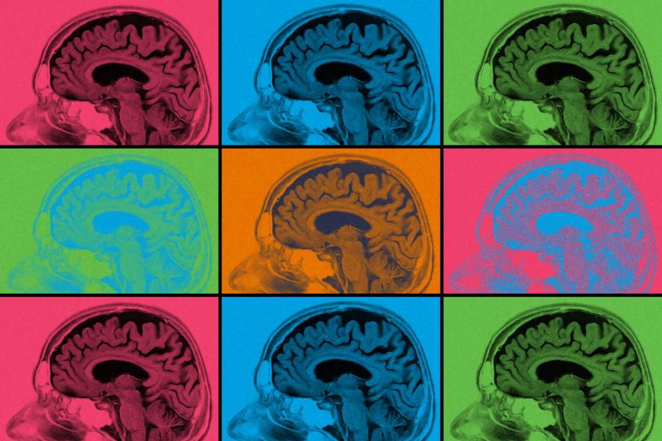 Collage of a scanned brain in various colors