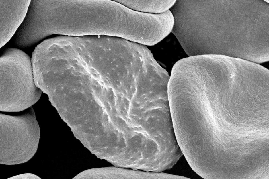 bumps called Knobs on a red blood cells
