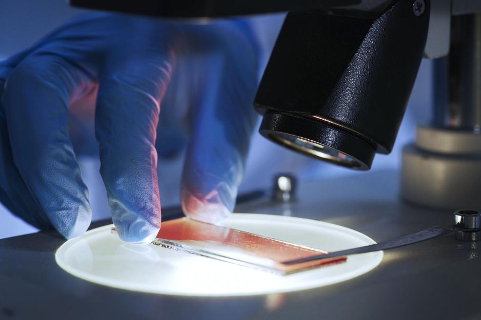 Slide smear placed on a micropscope