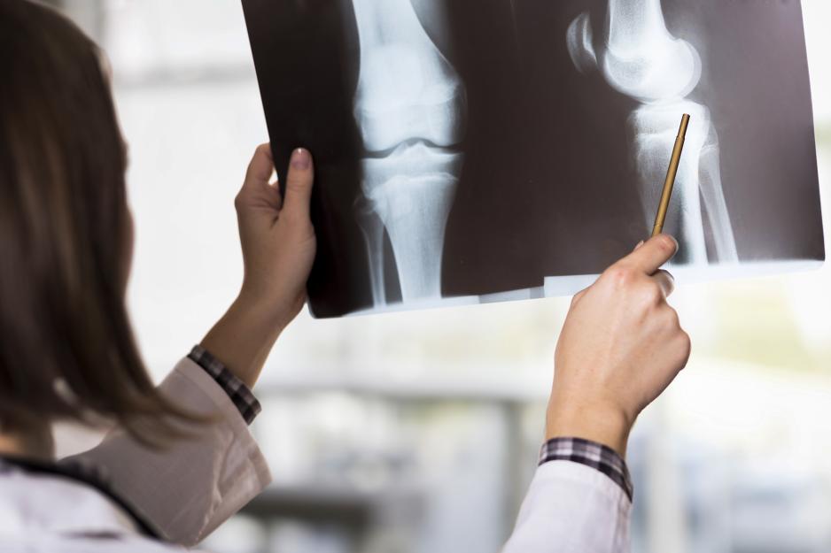 Doctor looking at an x-ray pointing to a joint