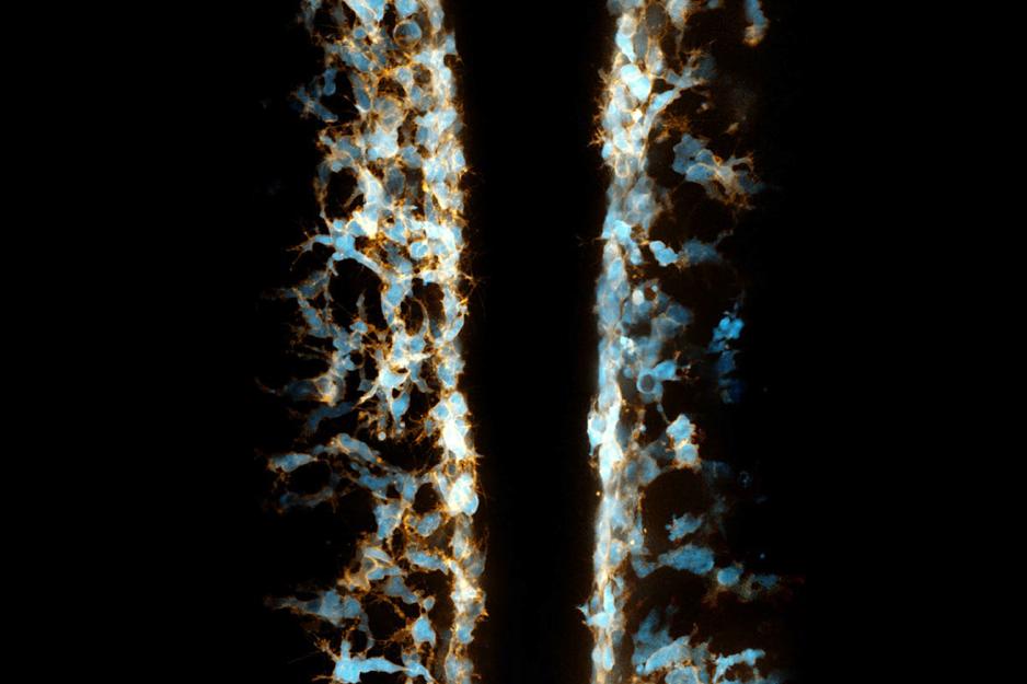 Zebrafish embryo