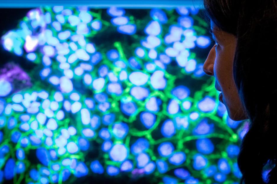 Woman looking at cells on a monitor