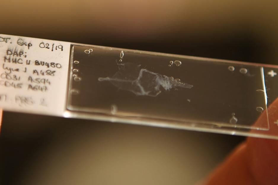  smear on a microscope slide